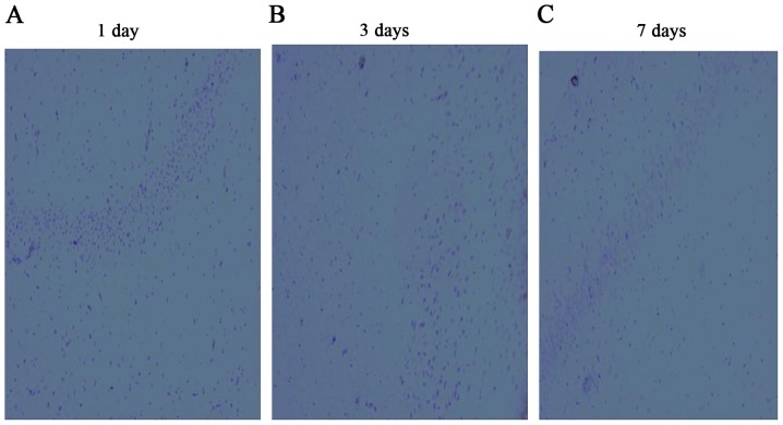 Figure 11.