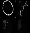 Figure 13.