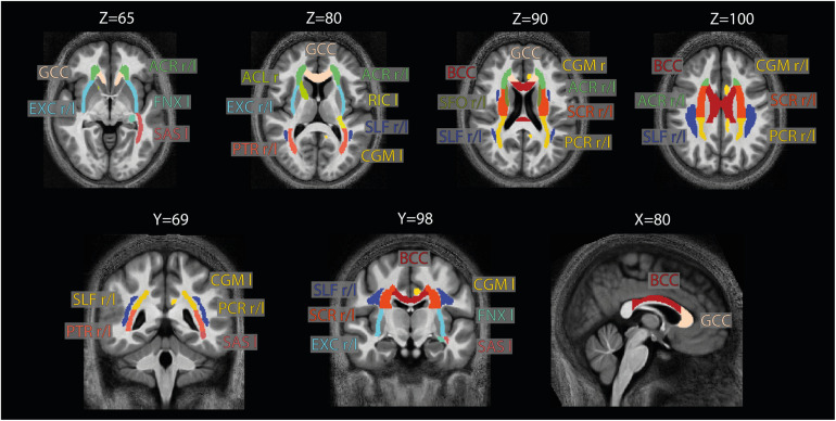 FIGURE 4