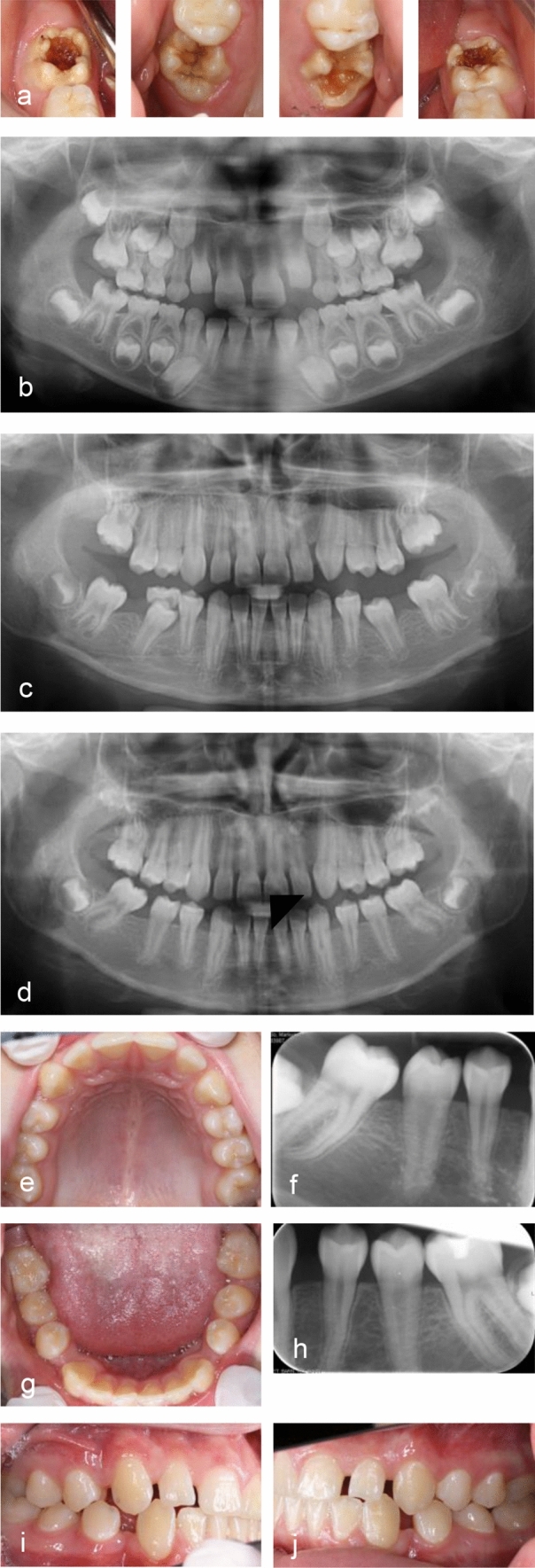 Fig. 3