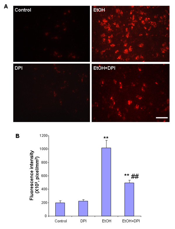 Figure 11