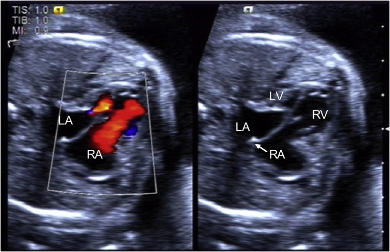 Fig. 1