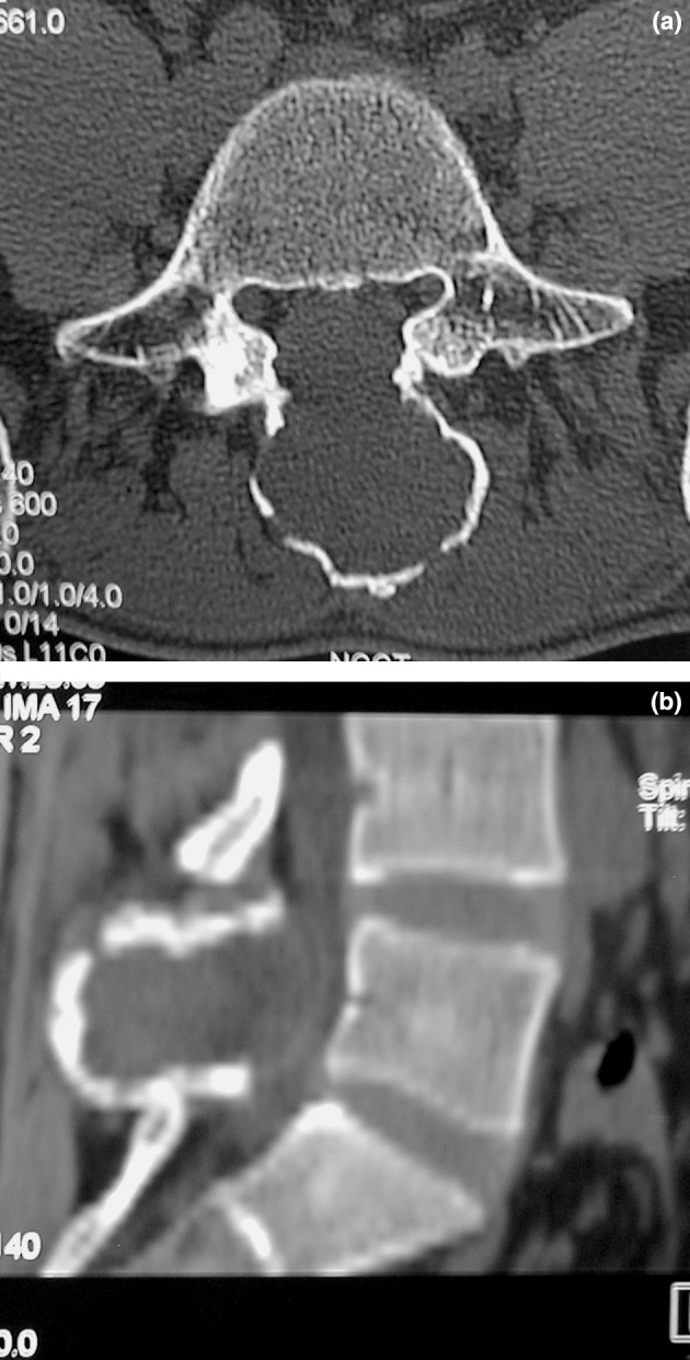 Fig. 1