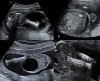 Fig. 3