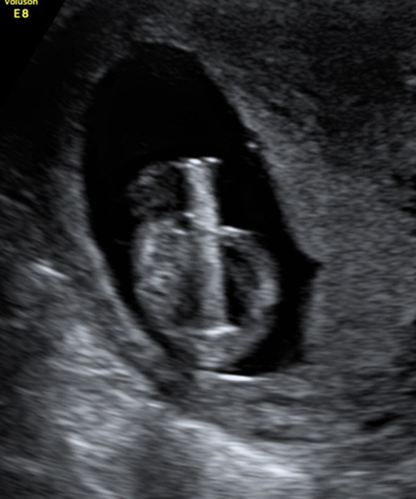 Fig. 2
