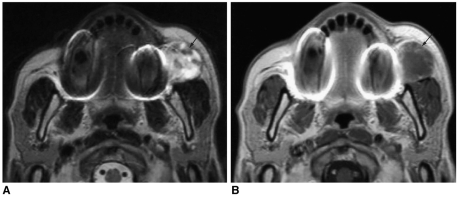 Fig. 11