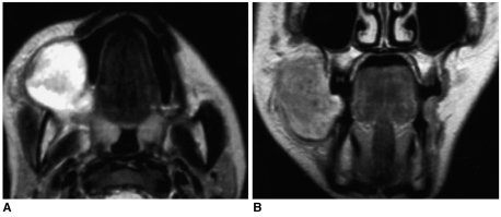 Fig. 12