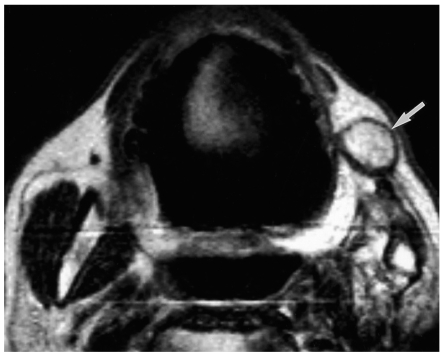 Fig. 16