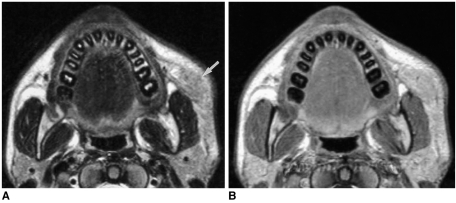 Fig. 18