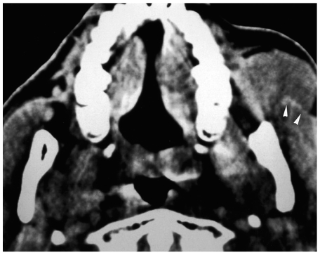 Fig. 14