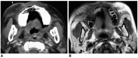 Fig. 15