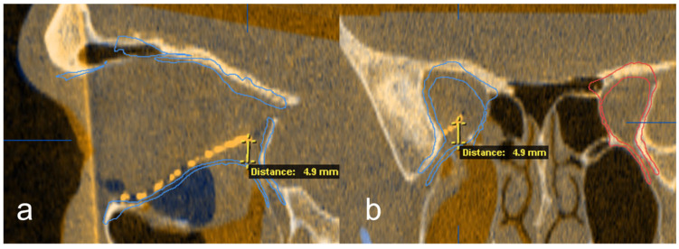 Figure 5