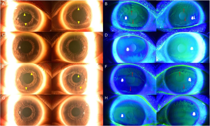 Fig. 4