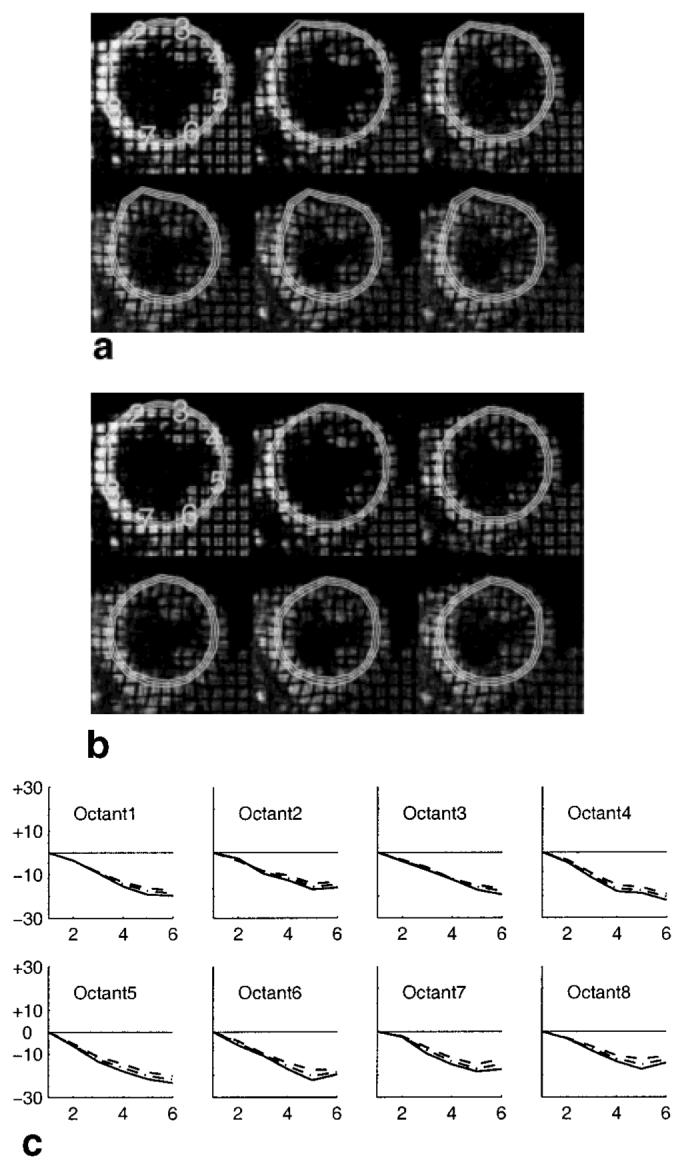 FIG. 9