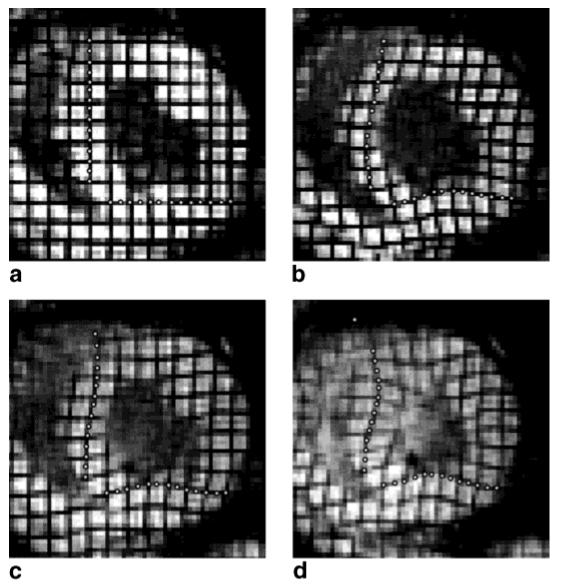 FIG. 5