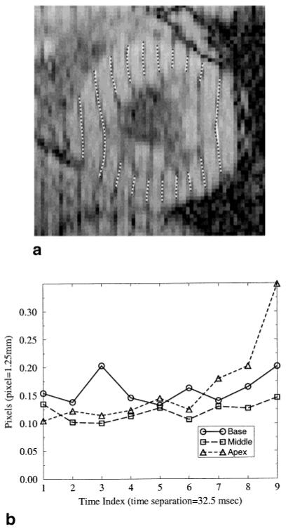 FIG. 10