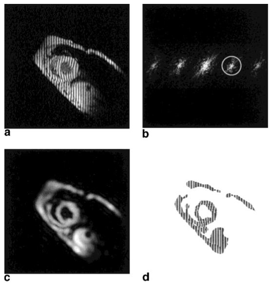 FIG. 1