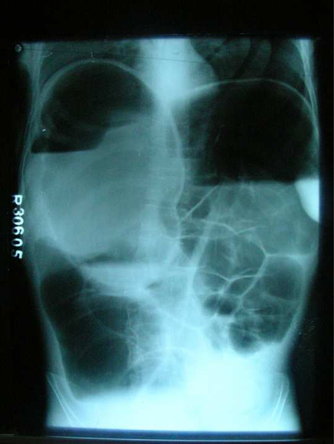 Fig. 1