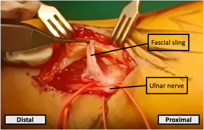 Figure 6