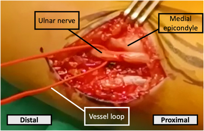 Figure 3