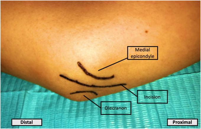 Figure 1