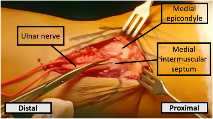 Figure 4