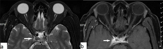 Figure 14