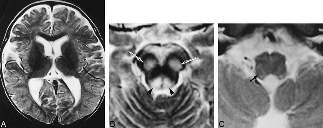 fig 3.