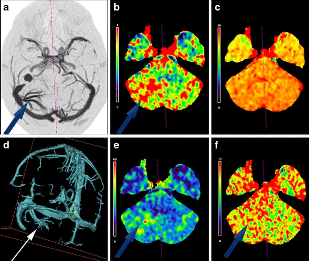 Fig. 4