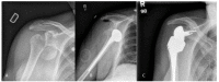 Fig. (1)