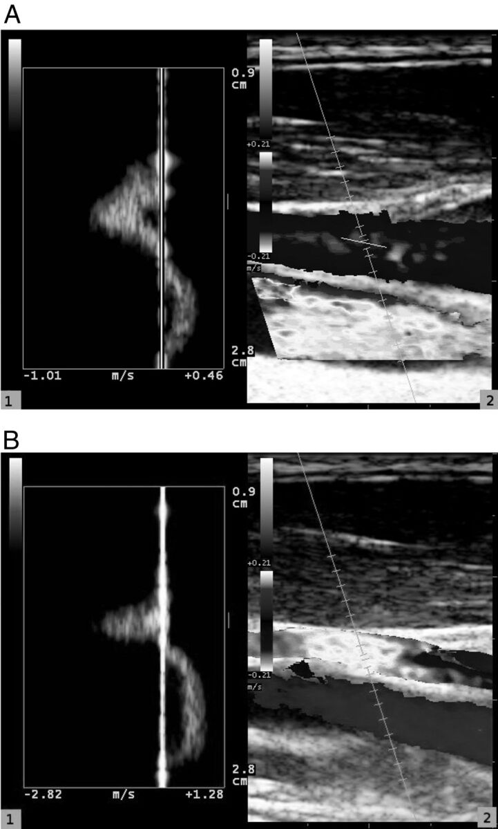 Fig 2.