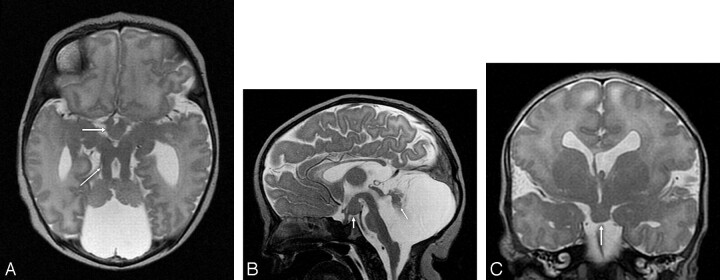 Fig 2.