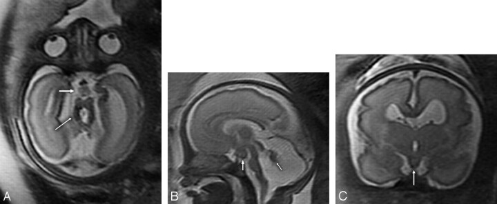 Fig 1.