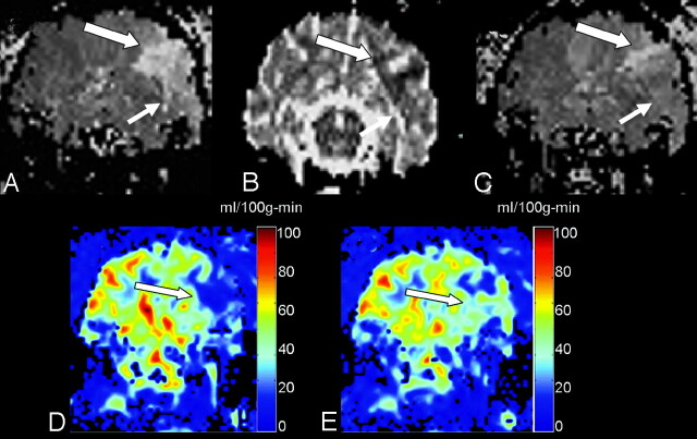 Fig 4.