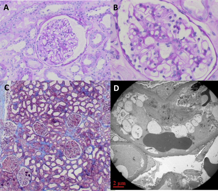 Figure 2