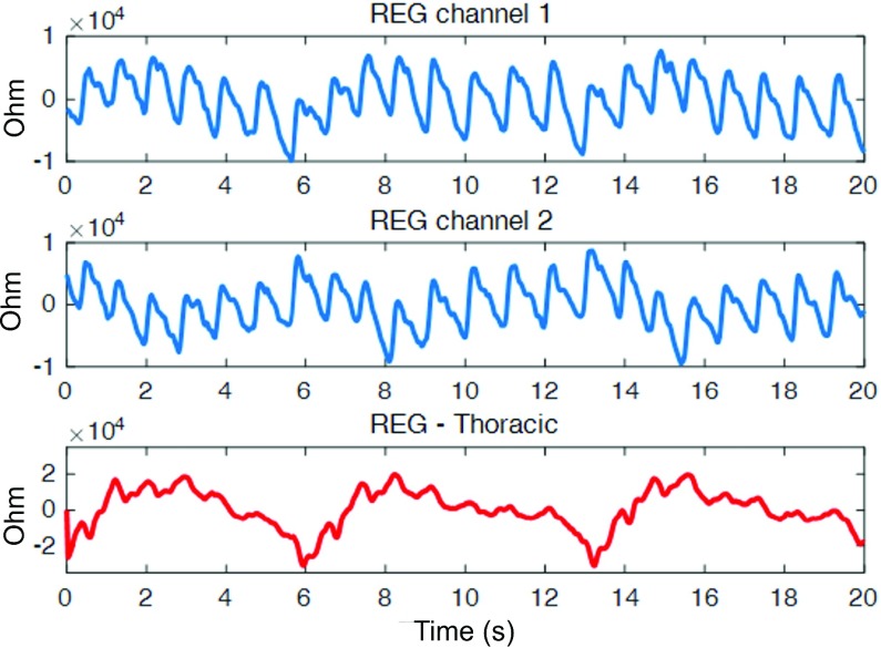 FIGURE 3.