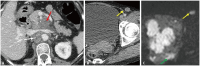 Fig. 15