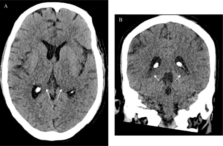 Fig 2