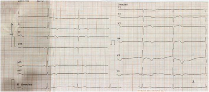 FIGURE 2