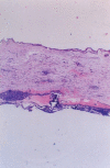 Figure 4a