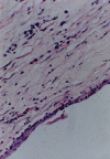 Figure 4b