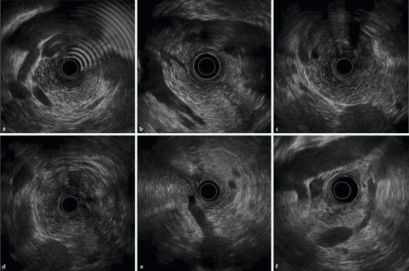 Fig. 1