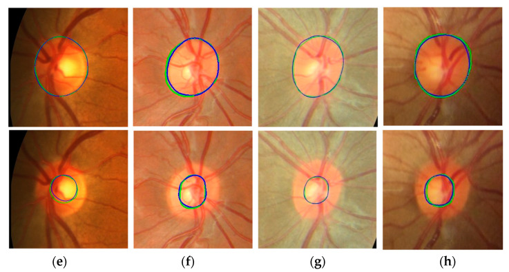 Figure 11