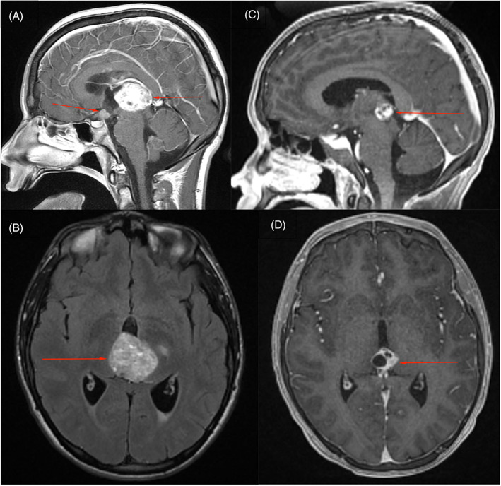 FIGURE 1