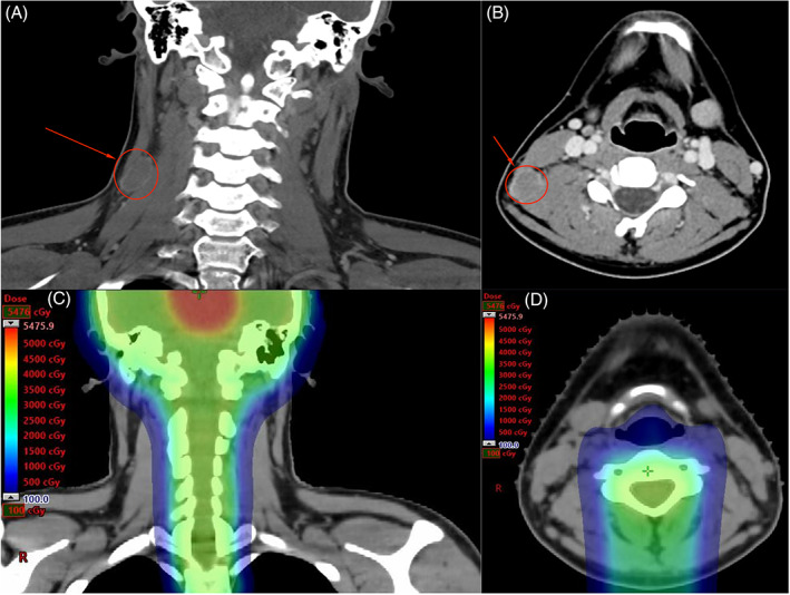 FIGURE 2