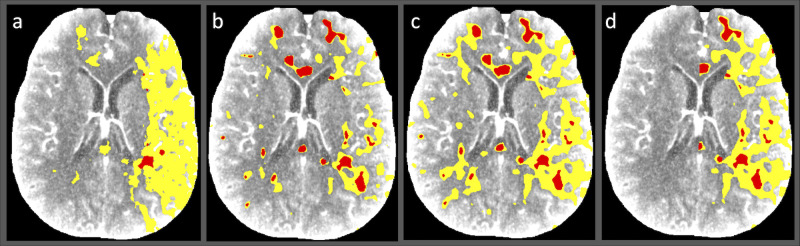 Fig 4