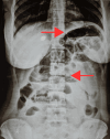 Fig. 1