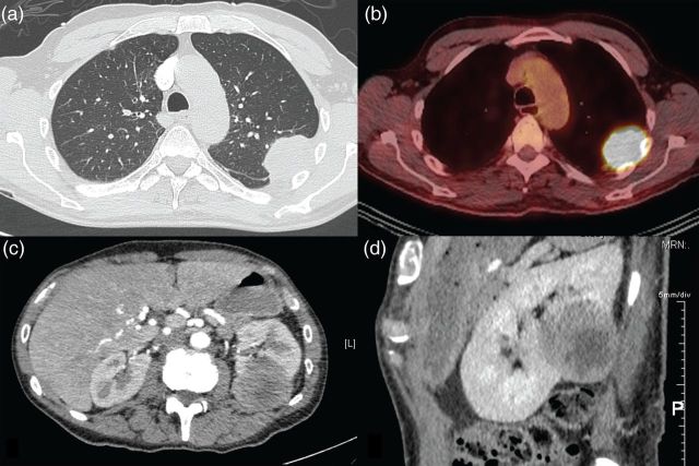 Figure 1: