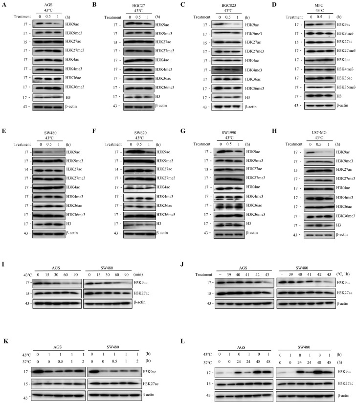 Inhibition of Heat Shock-Induced H3K9ac Reduction Sensitizes Cancer ...