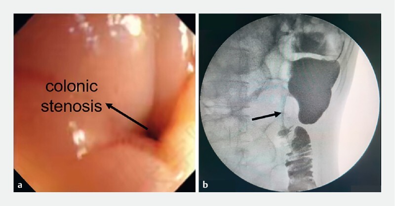 Fig. 1